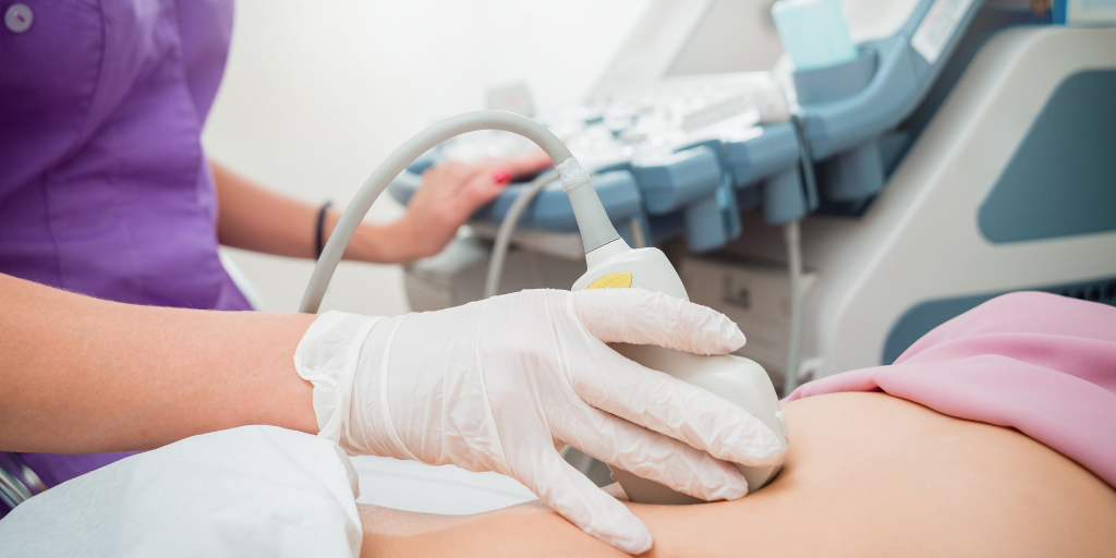 Why do I need an ultrasound if I'm having an abortion? 